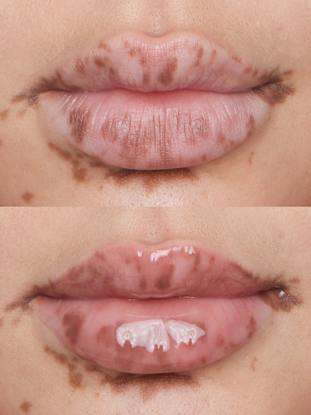 REFY LIP GLOSS BEFORE AND AFTER